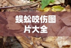 蜈蚣咬伤图片大全